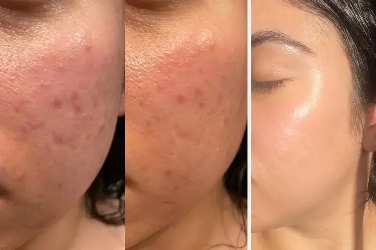 Cleansing the face 1.jpg min روتین مراقبت روزانه از پوست بر اساس نوع پوست